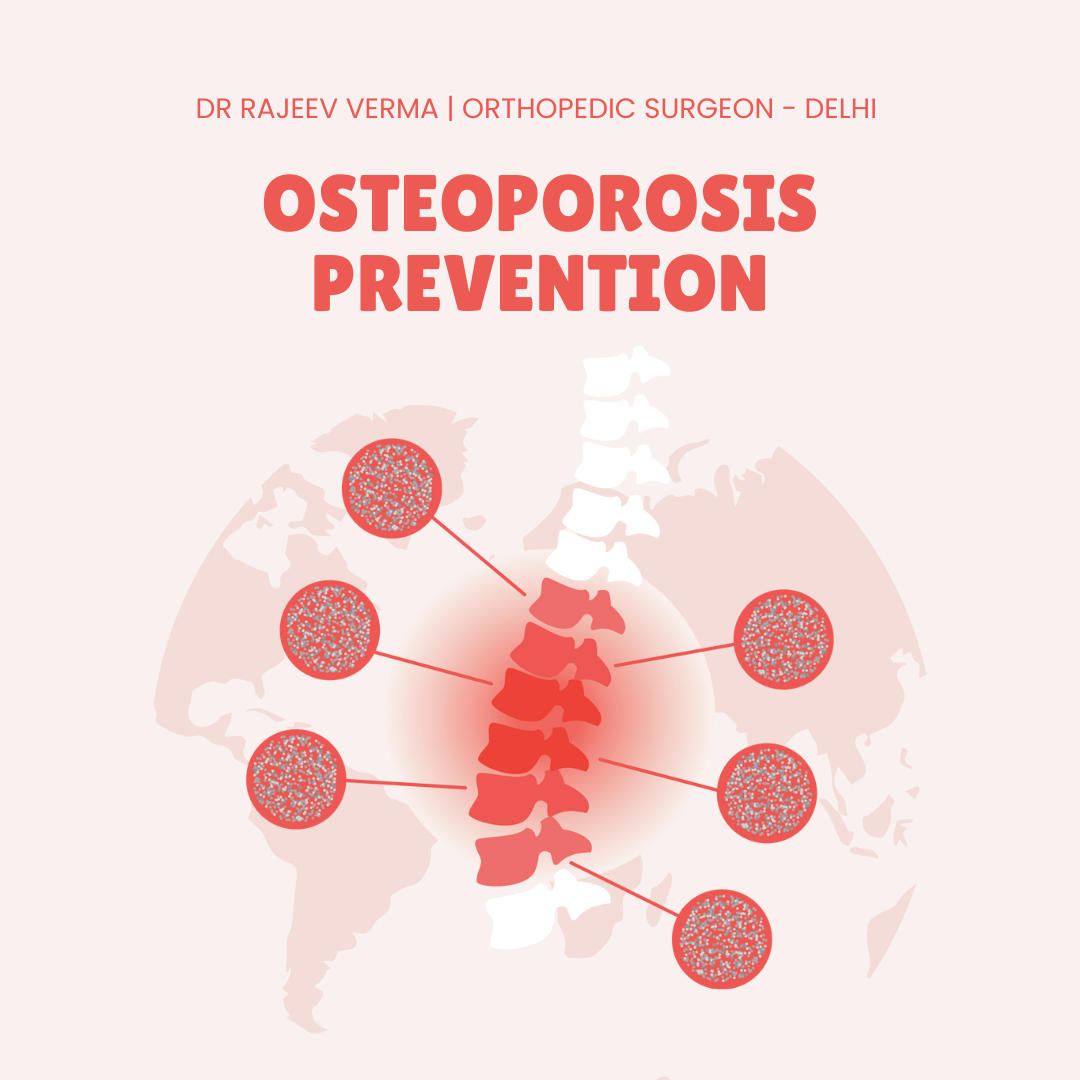 Prevent osteoporosis, reduce risk of fractures at old age- Orthopedic Surgeon Dr Rajeev Verma | World Osteoporosis Day 2025